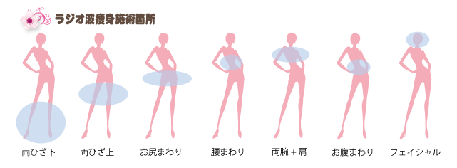 ラジオ波痩身施術箇所
